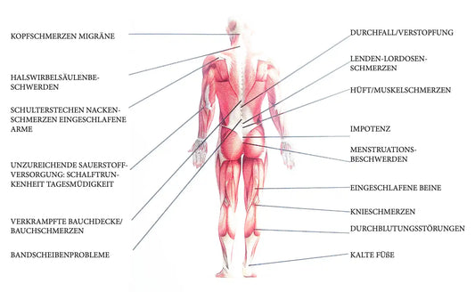 Anatomische Illustration des menschlichen Muskel- und Skelettsystems von hinten, mit häufigen Gesundheitsbeschwerden, die bestimmten Körperregionen zugeordnet sind.